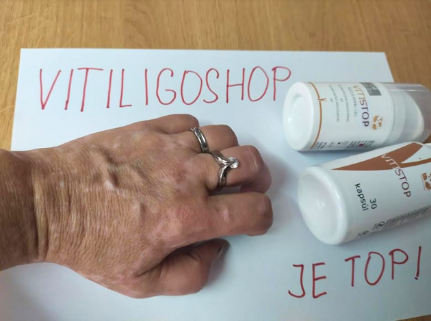 Vitiligoshop produkt