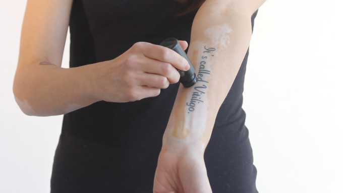 vitiligo makeup