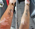 Vitiligo Startovací Sada (200 ml gel + 60 tablet + korektor Zanderm)