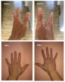 Vitiligo Startovací Sada (200 ml gel + 60 tablet + korektor Zanderm)